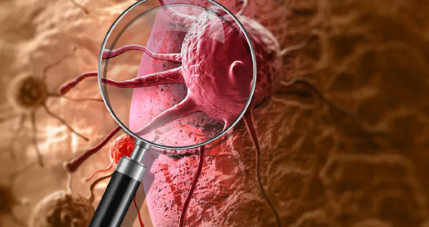 World&rsquo;s first personalised cancer vaccine trial for children to begin in Australia