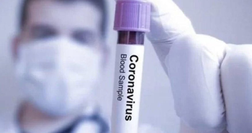 Koronavirusun yeni ştampı aşkar edilib