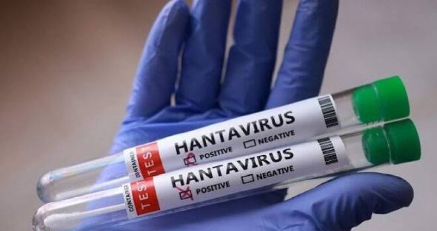 Hantavirusa yoluxanların sayı 13-ə çatıb
