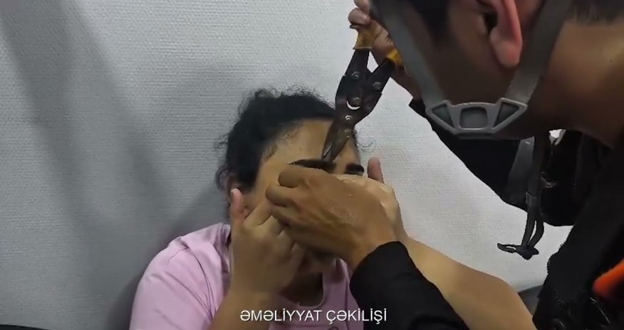 Göz qapağı geyiminin zəncirbəndinə ilişən qadına köməklik göstərilib - Video
