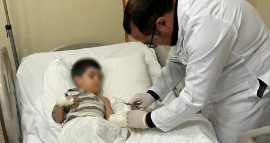 3 yaşlı uşağın ət maşınında amputasiya olunan əli 8 saatlıq əməliyyatla bərpa edilib