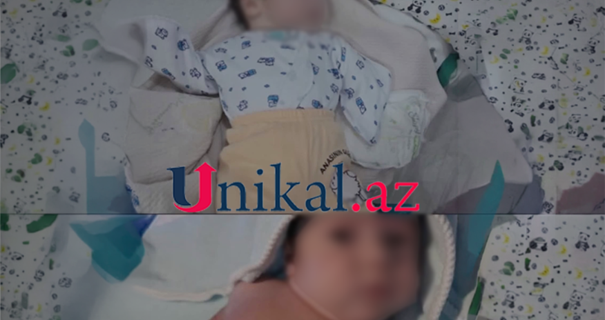 Sabunçuda qolları olmayan körpə doğulub, anası ondan imtina edib